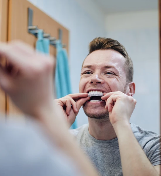 Gouttières invisibles