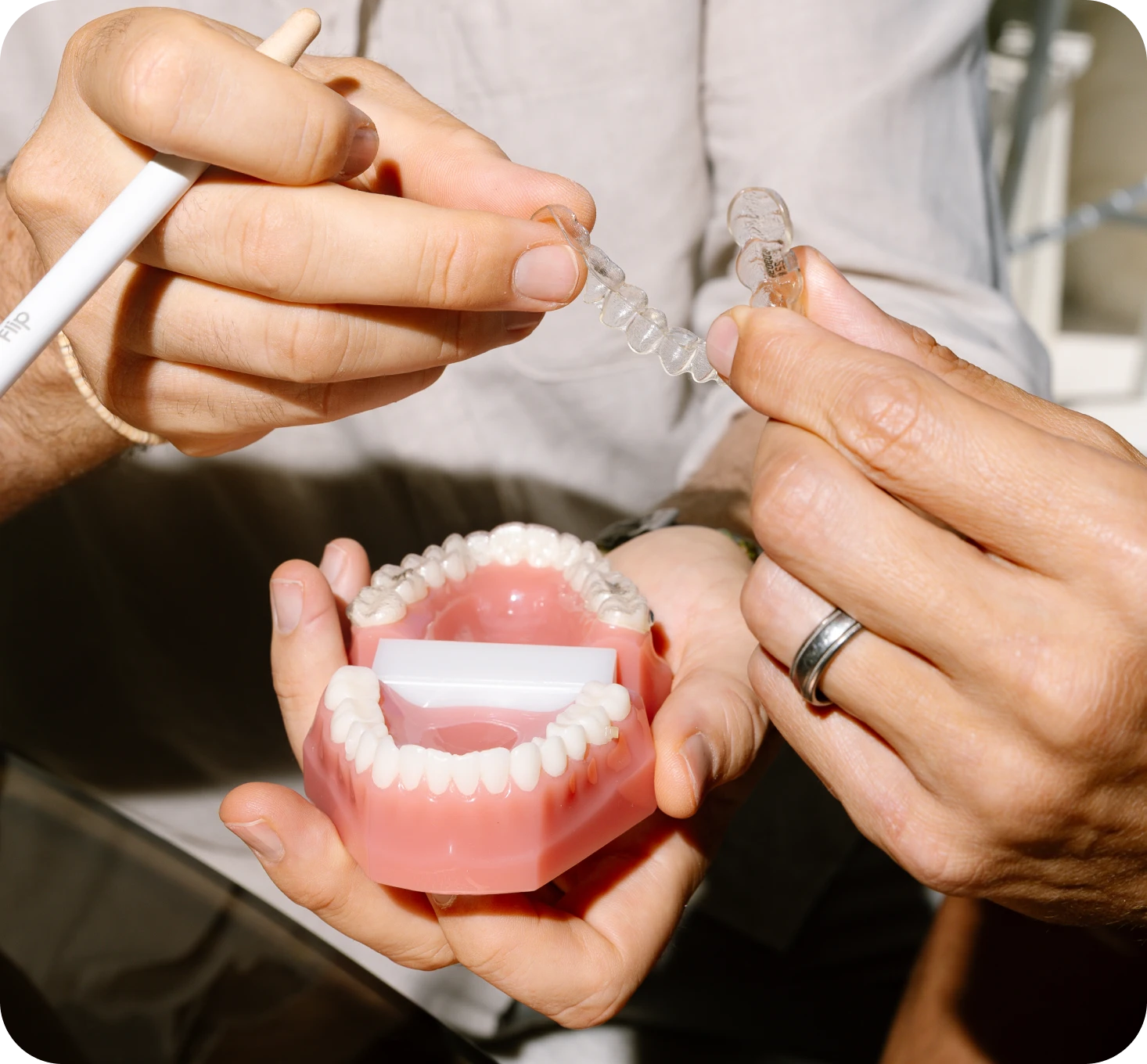 Aligneurs invisibles et orthodontie linguale