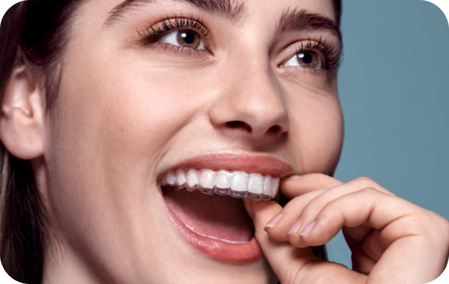 Invisalign braces near Monaco