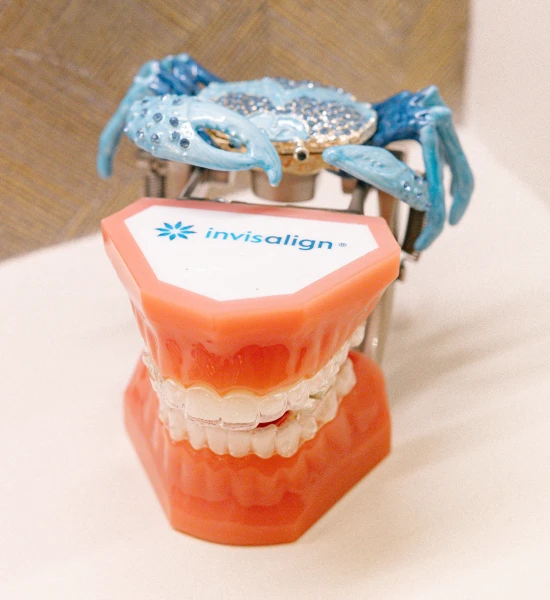 Orthodontie adulte par aligneurs transparents au cabinet Joséphine à Beausoleil