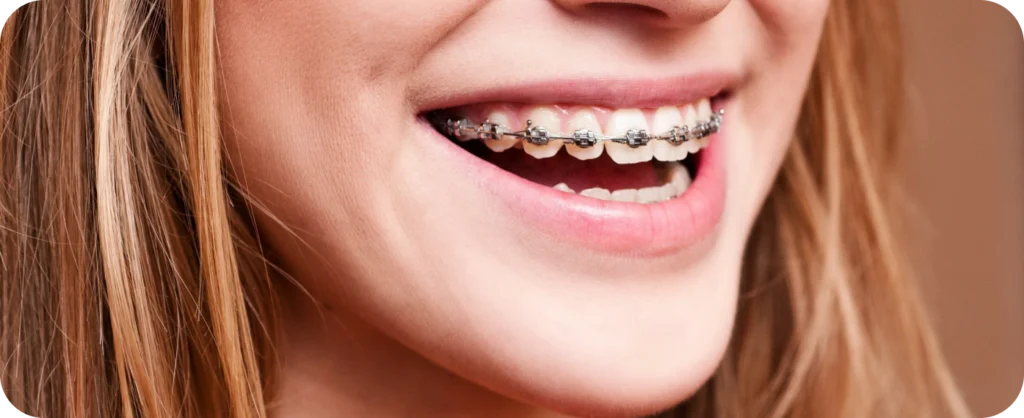 Orthodontiste à Monaco